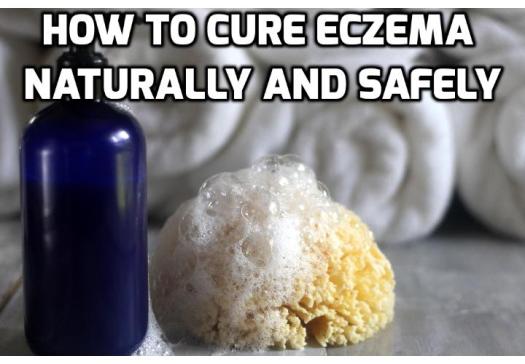 4 Natural Remedies for Eczema - There are different prescribed medications in the market today. However, such medications do not provide a cure for eczema. Rather, they only suppress the symptoms and weaken the already volatile immune system. With that, natural remedies for eczema are the best solutions. Read on to find out more.