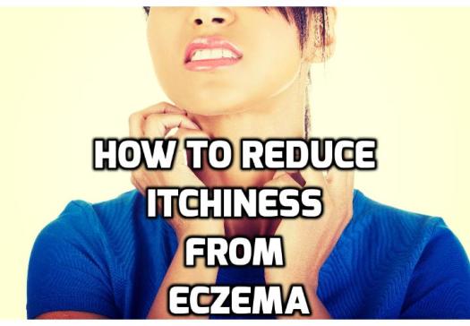 How to Soothe Eczema Itchiness and Prevent Scratching? Eczema is one condition that is painful, uncomfortable and yes, even debilitating. For many people the search for an effective, safe and inexpensive way to relieve eczema itch is a constant struggle. Here are some home remedies for you to soothe eczema itchiness and prevent scratching.