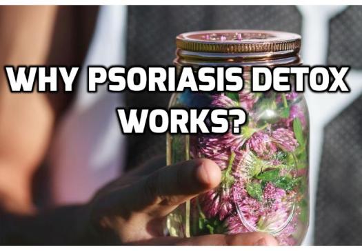 Why Psoriasis Detox Really Is Absolutely Best for Skin? A good at home psoriasis detox program can help remove the excess waste from the body especially if you are suffering from this skin condition. There are many options when working to do psoriasis detox. Read on here to find out more.