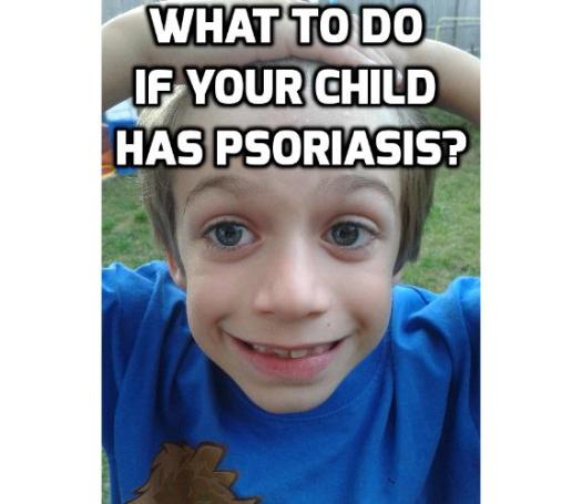 How to Get the Best Psoriasis Treatment for Children? Parents are supposed to protect their child from danger and keep them disease free so they live a full and happy life. Read on here to find out how you can get the best psoriasis treatment for children.
